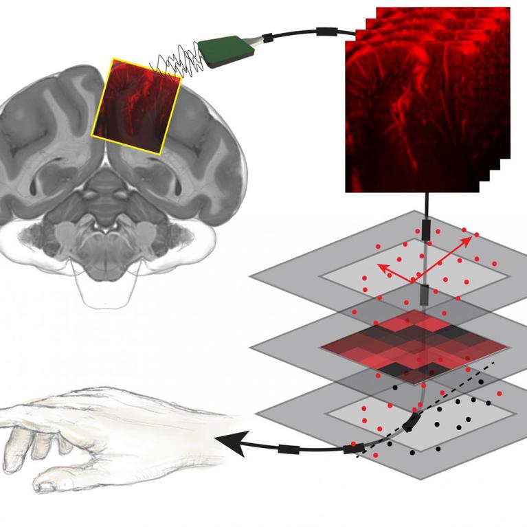 functional ultrasound device for predicting movements
