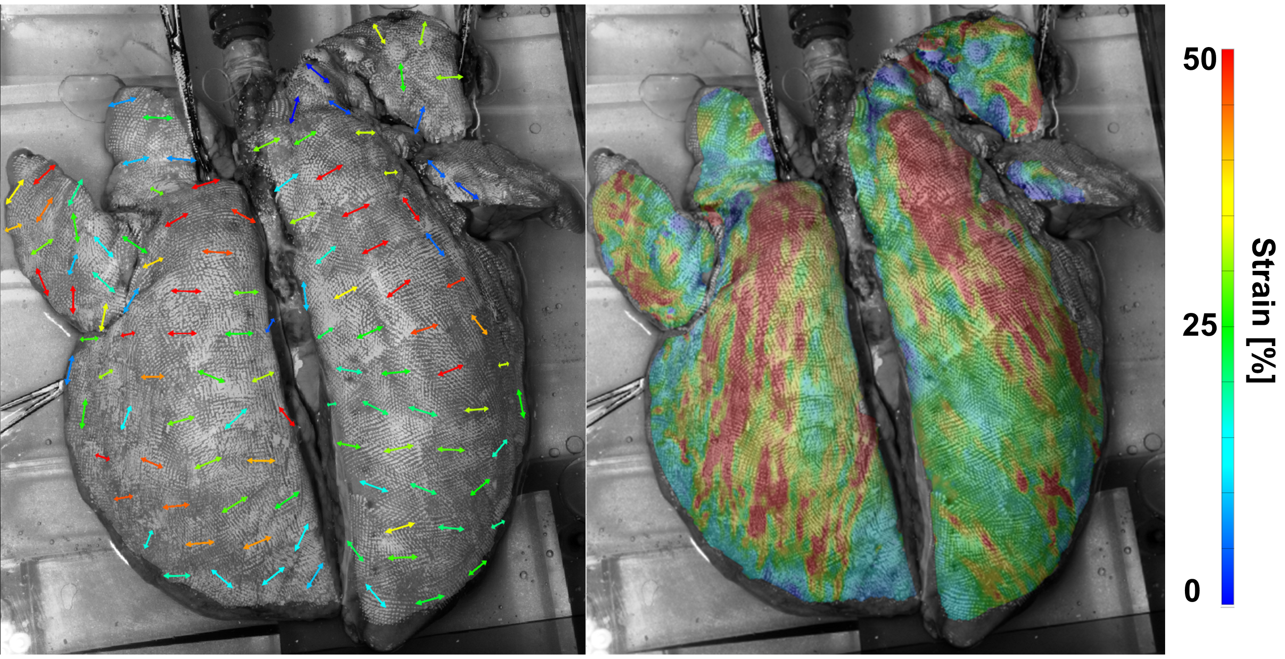  Digital image correlation techniques employed in Eskandari's lab to characterize lung mechanics.