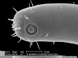 Electron microscope image of a nematode. (Image courtesy of Jim Baldwin and Manuel Mundo-Ocampo)