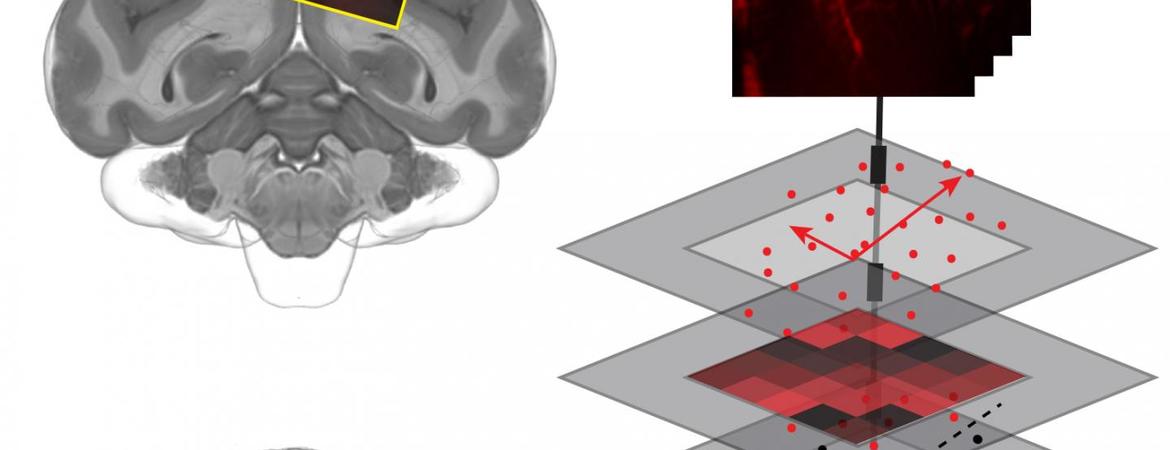 functional ultrasound device for predicting movements