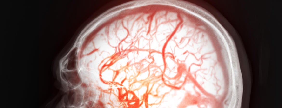Brain with blood vessels