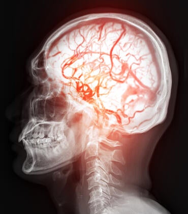 Brain with blood vessels