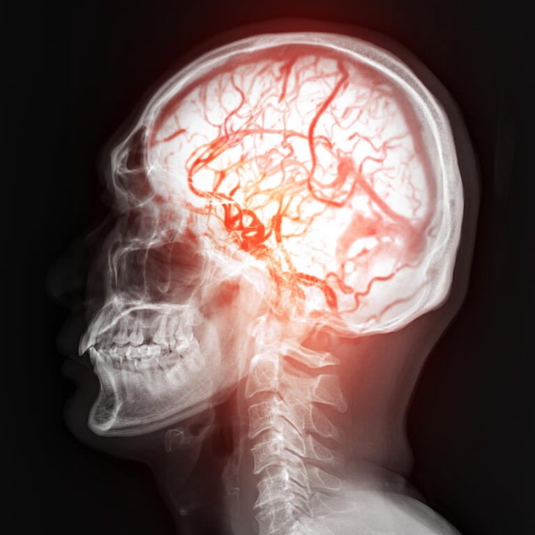 Brain with blood vessels